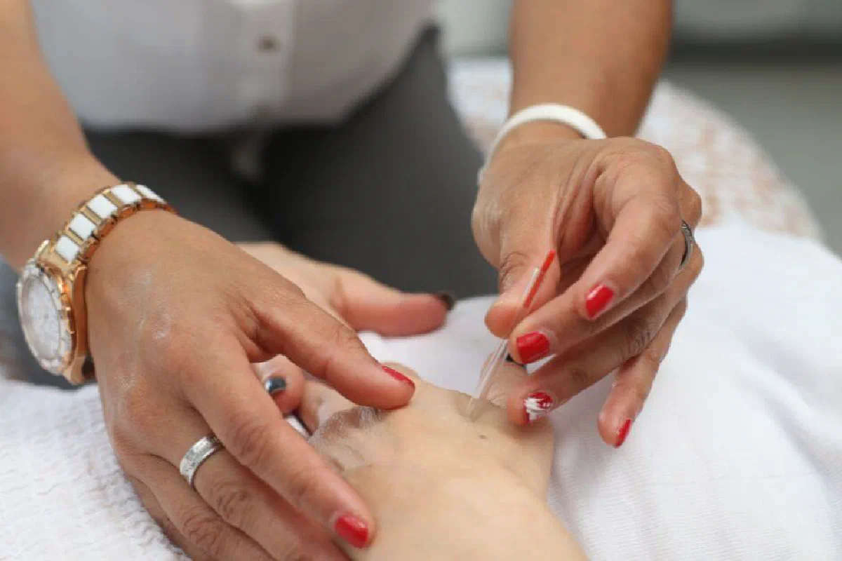 Is it okay for a Christian to participate in acupuncture / acupressure?