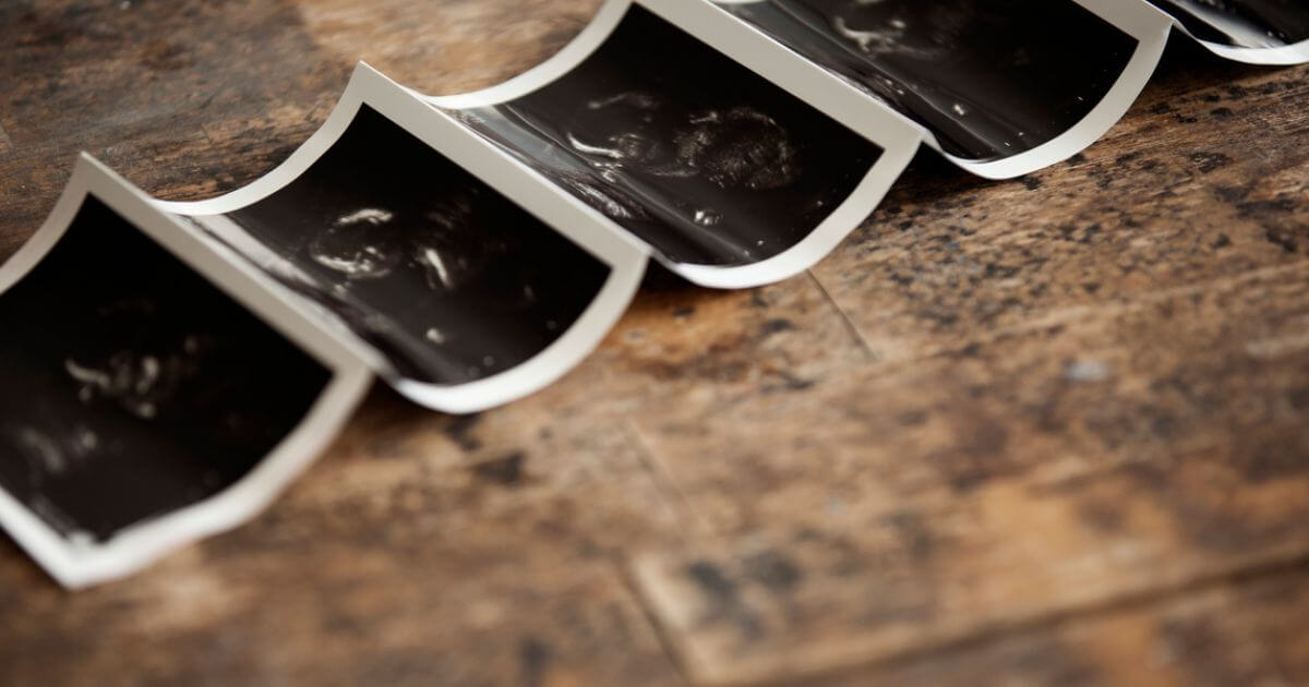 When does a life in the womb become a human being?