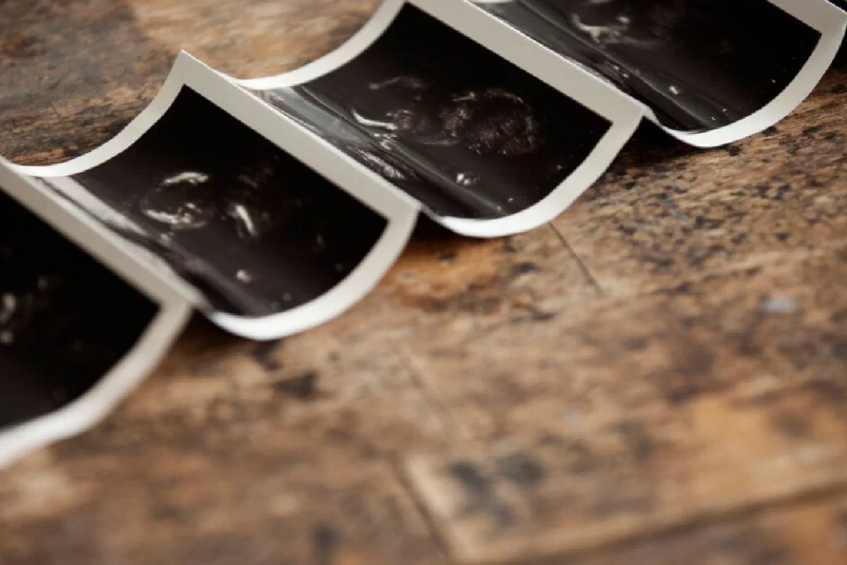 When does a life in the womb become a human being?