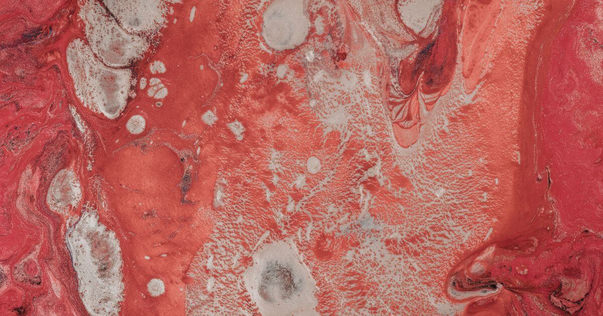 When Jesus was pierced, why did blood and water come out of His side?