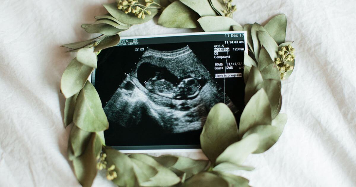 Does the Bible say anything about being a sperm/egg donor?