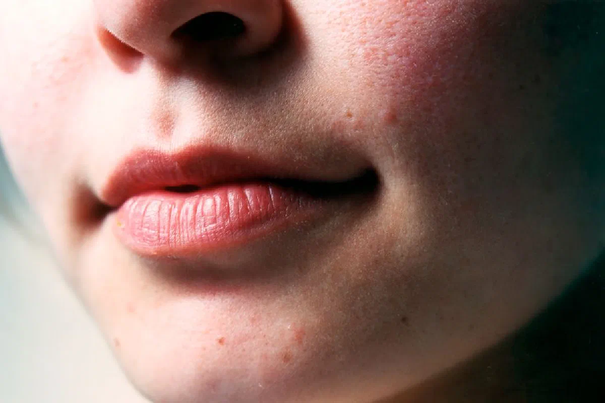 Close-up image highlighting a woman's lips and natural skin texture, focusing on facial features.