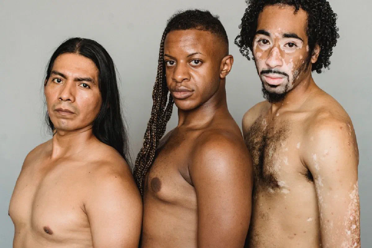 Crop Native American man standing close to black transgender partner and friend with vitiligo skin condition while looking at camera